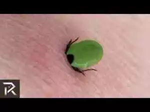 Video: 10 Creatures That Can Crawl Into Bodies